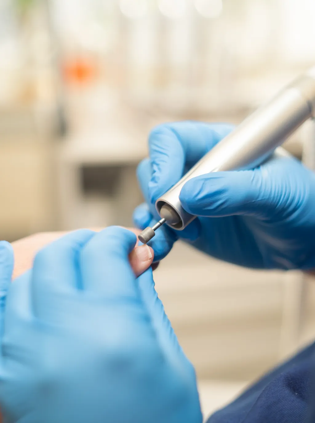 Nahaufnahme einer Nagelbehandlung mit podologischem Fräser