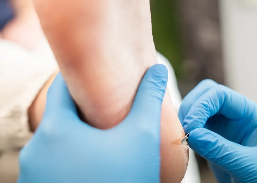 Podologin behandelt die Fußsohle einer Patientin mit Handschuhen